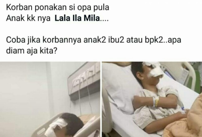 Pelajar SMP Pekanbaru korban perundungan yang viral di media sosial. 